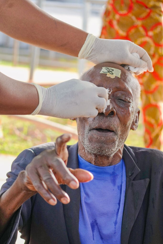 Ayedjoa Paparam receiving post-surgery eye care during Sight.org outreach