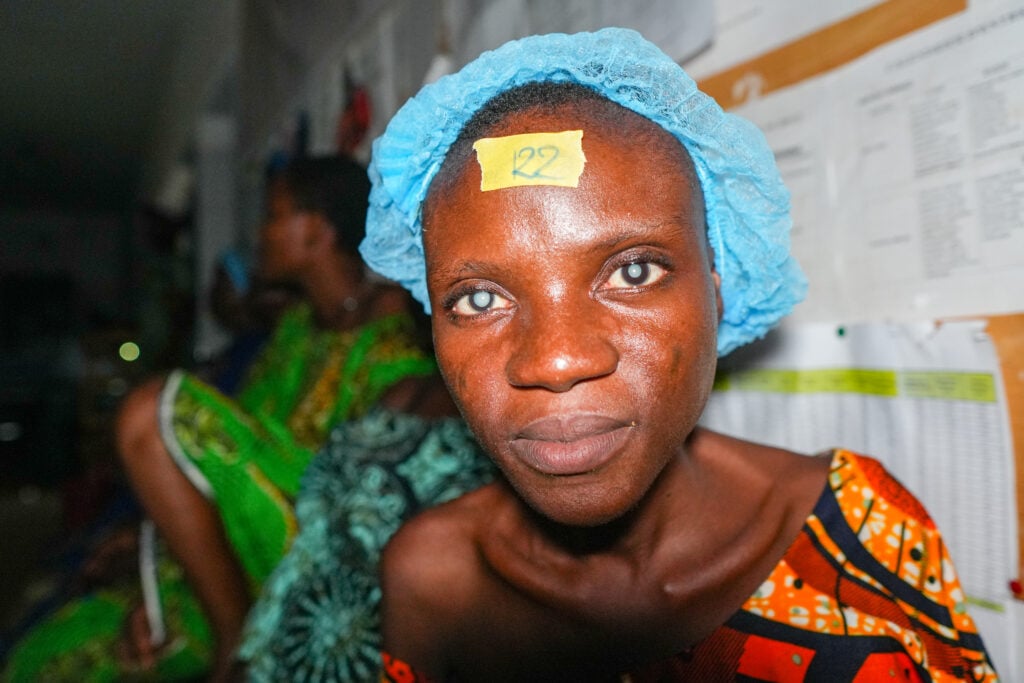 Amahaya before cataract surgery through Sight.org outreach