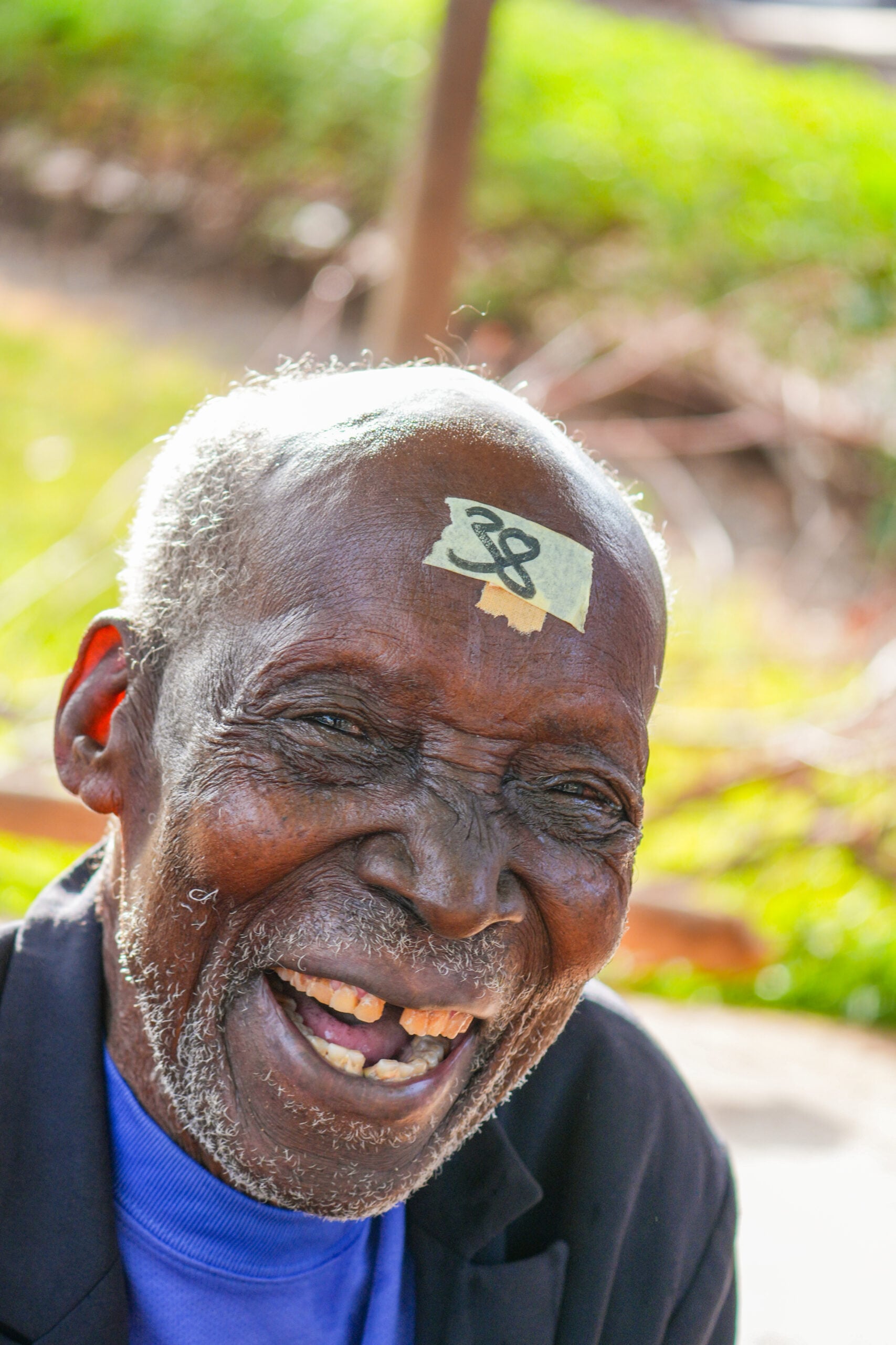 Ayedjoa Paparam smiling after cataract surgery in rural Togo