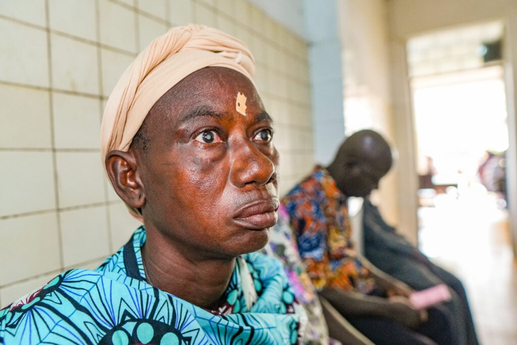 Bayale before cataract surgery through Sight.org outreach in Atakpamé