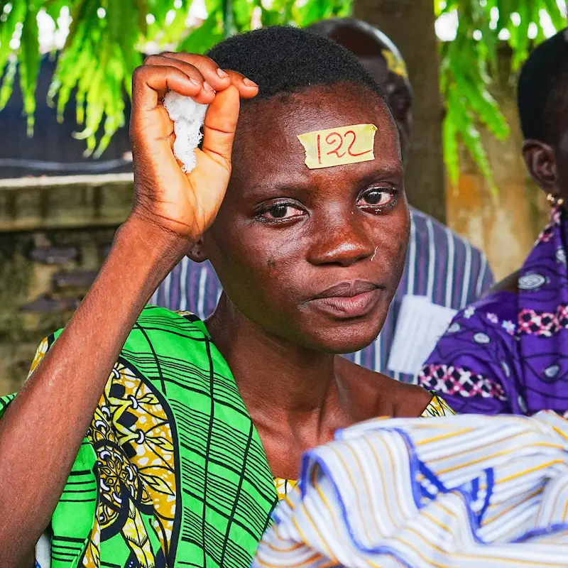 Togolese girl after she received cataract surgery from Sight.org Togolese girl after she received cataract surgery from Sight.org
