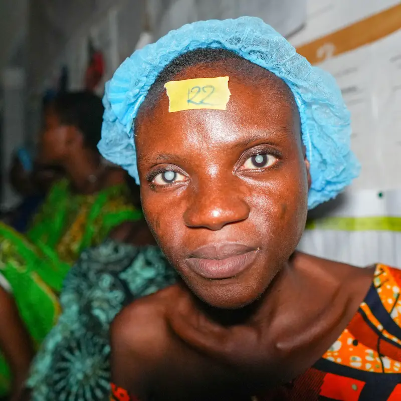 Togolese girl before she received cataract surgery from Sight.org Togolese girl before she received cataract surgery from Sight.org