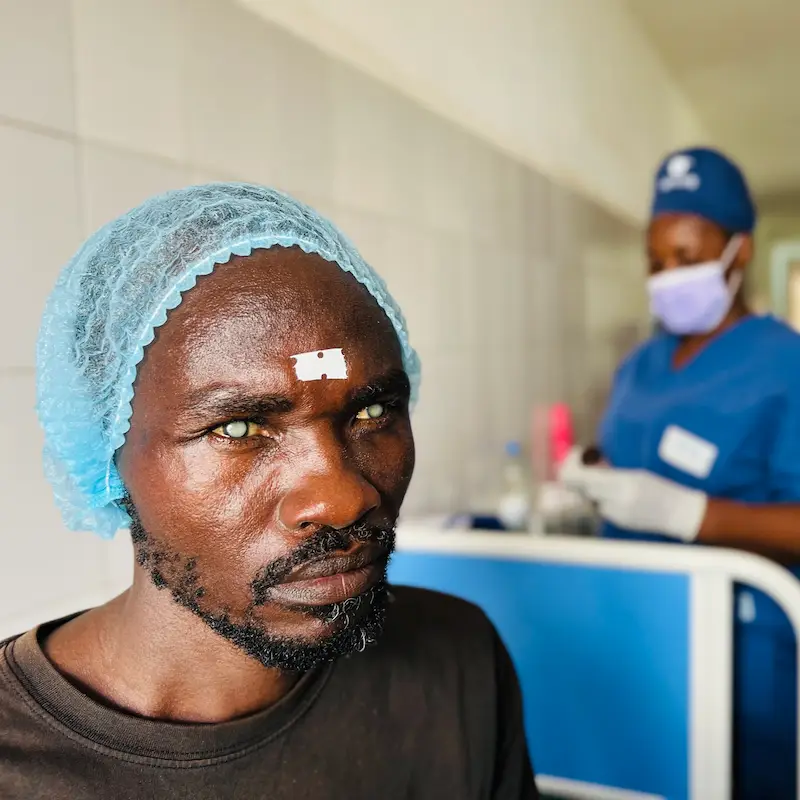 Togolese man before he received cataract surgery from Sight.org Togolese man before he received cataract surgery from Sight.org